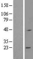 RNF183 Protein - Western validation with an anti-DDK antibody * L: Control HEK293 lysate R: Over-expression lysate