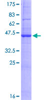 RNF183 Protein - 12.5% SDS-PAGE of human RNF183 stained with Coomassie Blue