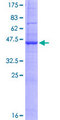 RNF183 Protein - 12.5% SDS-PAGE of human RNF183 stained with Coomassie Blue