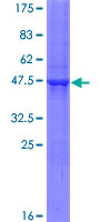 RNF185 Protein - 12.5% SDS-PAGE of human RNF185 stained with Coomassie Blue
