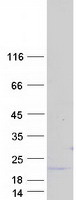 RNF185 Protein - Purified recombinant protein RNF185 was analyzed by SDS-PAGE gel and Coomassie Blue Staining