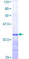 RNF186 Protein - 12.5% SDS-PAGE Stained with Coomassie Blue.