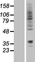 RNF19A / DORFIN Protein - Western validation with an anti-DDK antibody * L: Control HEK293 lysate R: Over-expression lysate
