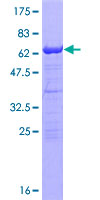 RNF2 / RING2 / RING1B Protein - 12.5% SDS-PAGE of human RNF2 stained with Coomassie Blue
