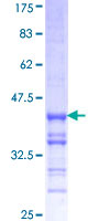 RNF2 / RING2 / RING1B Protein - 12.5% SDS-PAGE Stained with Coomassie Blue.