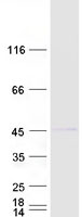 RNF2 / RING2 / RING1B Protein - Purified recombinant protein RNF2 was analyzed by SDS-PAGE gel and Coomassie Blue Staining