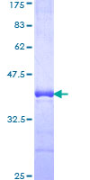 RNF20 Protein - 12.5% SDS-PAGE Stained with Coomassie Blue.