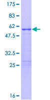 RNF207 Protein - 12.5% SDS-PAGE of human FLJ46380 stained with Coomassie Blue