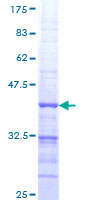 RNF207 Protein - 12.5% SDS-PAGE Stained with Coomassie Blue.