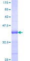 RNF208 Protein - 12.5% SDS-PAGE Stained with Coomassie Blue