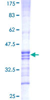 RNF212 Protein - 12.5% SDS-PAGE Stained with Coomassie Blue.