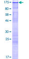 RNF213 Protein - 12.5% SDS-PAGE of human KIAA1618 stained with Coomassie Blue