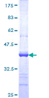 RNF213 Protein - 12.5% SDS-PAGE Stained with Coomassie Blue.