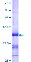 RNF214 Protein - 12.5% SDS-PAGE Stained with Coomassie Blue.