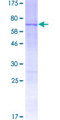 RNF215 Protein - 12.5% SDS-PAGE of human RNF215 stained with Coomassie Blue