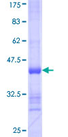 RNF217 / IBRDC1 Protein - 12.5% SDS-PAGE Stained with Coomassie Blue.