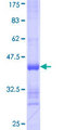 RNF217 / IBRDC1 Protein - 12.5% SDS-PAGE Stained with Coomassie Blue.