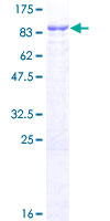 RNF220 / C1orf164 Protein - 12.5% SDS-PAGE of human C1orf164 stained with Coomassie Blue