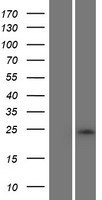 RNF222 Protein - Western validation with an anti-DDK antibody * L: Control HEK293 lysate R: Over-expression lysate