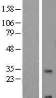 RNF24 Protein - Western validation with an anti-DDK antibody * L: Control HEK293 lysate R: Over-expression lysate