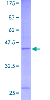 RNF24 Protein - 12.5% SDS-PAGE of human RNF24 stained with Coomassie Blue