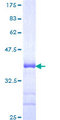 RNF24 Protein - 12.5% SDS-PAGE Stained with Coomassie Blue.