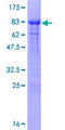 RNF25 Protein - 12.5% SDS-PAGE of human RNF25 stained with Coomassie Blue