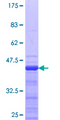 RNF25 Protein - 12.5% SDS-PAGE Stained with Coomassie Blue.
