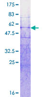 RNF32 Protein - 12.5% SDS-PAGE of human RNF32 stained with Coomassie Blue