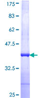 RNF32 Protein - 12.5% SDS-PAGE Stained with Coomassie Blue.
