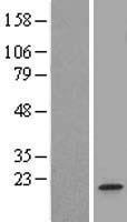 RNF34 Protein - Western validation with an anti-DDK antibody * L: Control HEK293 lysate R: Over-expression lysate