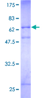 RNF34 Protein - 12.5% SDS-PAGE of human RNF34 stained with Coomassie Blue