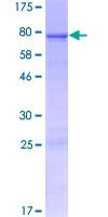RNF39 Protein - 12.5% SDS-PAGE of human RNF39 stained with Coomassie Blue
