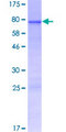RNF39 Protein - 12.5% SDS-PAGE of human RNF39 stained with Coomassie Blue
