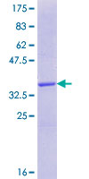 RNF39 Protein - 12.5% SDS-PAGE Stained with Coomassie Blue.