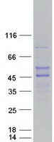 RNF39 Protein - Purified recombinant protein RNF39 was analyzed by SDS-PAGE gel and Coomassie Blue Staining