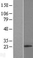 RNF4 Protein - Western validation with an anti-DDK antibody * L: Control HEK293 lysate R: Over-expression lysate