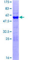 RNF4 Protein - 12.5% SDS-PAGE of human RNF4 stained with Coomassie Blue