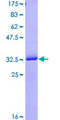 RNF4 Protein - 12.5% SDS-PAGE Stained with Coomassie Blue.