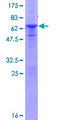 RNF41 Protein - 12.5% SDS-PAGE of human RNF41 stained with Coomassie Blue