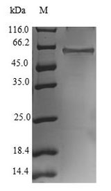 RNF41 Protein - (Tris-Glycine gel) Discontinuous SDS-PAGE (reduced) with 5% enrichment gel and 15% separation gel.