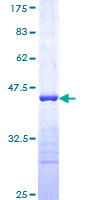 RNF6 Protein - 12.5% SDS-PAGE Stained with Coomassie Blue.