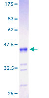 RNF7 Protein - 12.5% SDS-PAGE of human RNF7 stained with Coomassie Blue