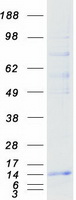 RNF7 Protein - Purified recombinant protein RNF7 was analyzed by SDS-PAGE gel and Coomassie Blue Staining