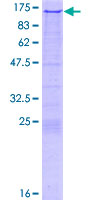RNF74 / RAG1 Protein - 12.5% SDS-PAGE of human RAG1 stained with Coomassie Blue