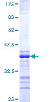 RNFT1 Protein - 12.5% SDS-PAGE Stained with Coomassie Blue.