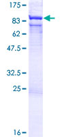 RNGTT / HCAP Protein - 12.5% SDS-PAGE of human RNGTT stained with Coomassie Blue