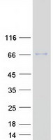 RNGTT / HCAP Protein - Purified recombinant protein RNGTT was analyzed by SDS-PAGE gel and Coomassie Blue Staining