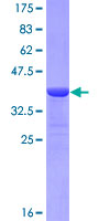 RNH1 Protein - 12.5% SDS-PAGE Stained with Coomassie Blue.
