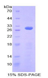 RNH1 Protein - Recombinant Ribonuclease Inhibitor By SDS-PAGE